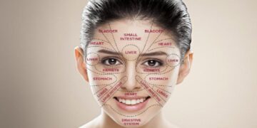 جوش زدن در هر قسمت از صورت نشانه چیست؟