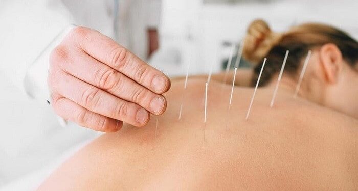 چه بیماری هایی با طب سوزنی قابل درمان است؟