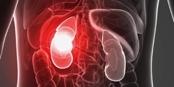 این نشانه های اولیه نارسایی کلیه است