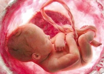 راه‌اندازی سامانه مشاوره ژنتیک برای پیشگیری از تولد کودکان معلول