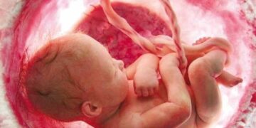 راه‌اندازی سامانه مشاوره ژنتیک برای پیشگیری از تولد کودکان معلول