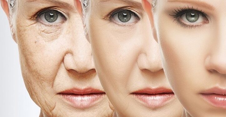 روش های طبیعی برای از بین بردن چروک پوست